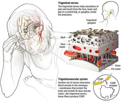Anti-migraine have 6 categories